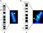 ScienceDirect.com - Gene - Evolution of GABAA receptor diversity ...