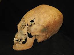 Image result for elongated skulls