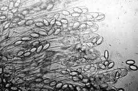 Attēlu rezultāti vaicājumam “Disciotis venosa”