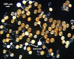 Attēlu rezultāti vaicājumam “Ombrophila violacea spores”