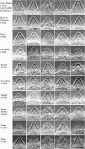 Attēlu rezultāti vaicājumam “Heterotrichia oerstedii (syn. Arcyria oerstedii) macro”