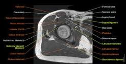 Lower limb: MRI anatomical atlas | e-Anatomy