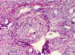Attēlu rezultāti vaicājumam “Odontoschisma denudatum cells”