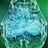 Attēlu rezultāti vaicājumam “Physarum braunianum plasmodium”