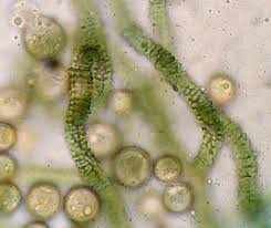 Attēlu rezultāti vaicājumam “Heterotrichia ferruginea (syn. Arcyria ferruginea)”