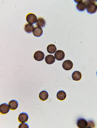 Attēlu rezultāti vaicājumam “Physarum braunianum spores”