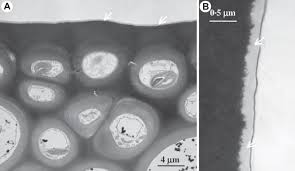 Attēlu rezultāti vaicājumam “Radula complanata sporophyte”