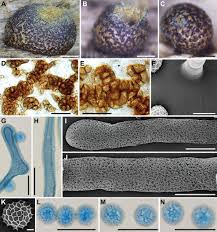 Attēlu rezultāti vaicājumam “Lycogala irregulare”