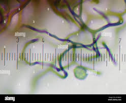 Attēlu rezultāti vaicājumam “Stemonitopsis hyperopta”