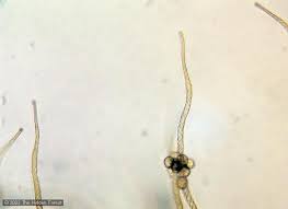 Attēlu rezultāti vaicājumam “Trichia crateriformis spores”