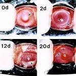 <b>Arthus reaction</b> in cornea