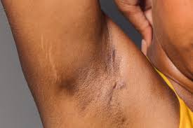 Image result for armpits are fine too