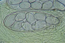 Attēlu rezultāti vaicājumam “Ascobolus furfuraceus”