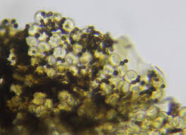 Attēlu rezultāti vaicājumam “Tubifera montana spores”