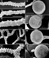 Attēlu rezultāti vaicājumam “Arcyria affinis spores”
