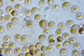 Attēlu rezultāti vaicājumam “Cribraria aurantiaca macro”