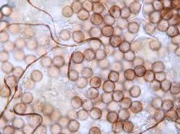 Attēlu rezultāti vaicājumam “Didymium verrucisporum stalked”