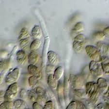 Attēlu rezultāti vaicājumam “Calicium salicinum”