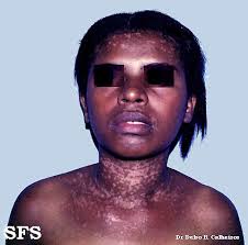 Image result for Lewandowsky-Lutz