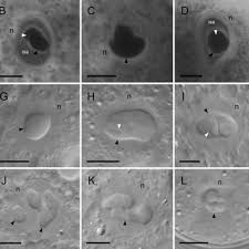 Attēlu rezultāti vaicājumam “Lycogala cf. fossiculatum”