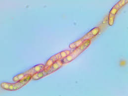 Attēlu rezultāti vaicājumam “Ruzenia spermoides”