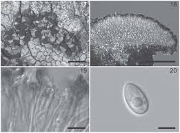Attēlu rezultāti vaicājumam “Hertelidea botryosa”