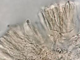 Attēlu rezultāti vaicājumam “Melanospora lagenaria”