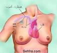 دواء «القنبلة الذكية» يهاجم خلايا أورام سرطان الثدي  Images?q=tbn:ANd9GcTFO38UNxl0SV2LIQUpGNGZmKn_o-31eg9ILxs4zB1iQ_imiuyu2JW4fg
