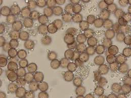 Attēlu rezultāti vaicājumam “Diderma effusum”