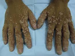 Image result for Lewandowsky-Lutz