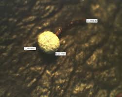 Attēlu rezultāti vaicājumam “Didymium megalosporum macro”