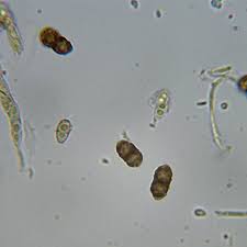 Attēlu rezultāti vaicājumam “Calicium salicinum”