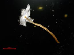 Attēlu rezultāti vaicājumam “Physarum pezizoideum stalked”