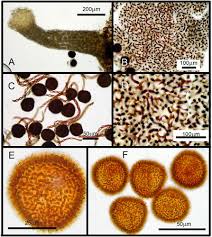 Attēlu rezultāti vaicājumam “Fossombronia foveolata sporophyte”