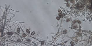 Attēlu rezultāti vaicājumam “Badhamiopsis macrospora spores”