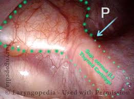 Attēlu rezultāti vaicājumam “Cribraria piriformis young”
