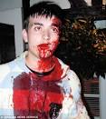 The face of Britain's knife crime scourge: Teenager mutilated ...