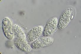 Attēlu rezultāti vaicājumam “Verrucaria hydrela”