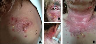 Attēlu rezultāti vaicājumam “Diderma subviridifuscum var. macrospora*”