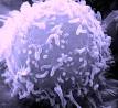 Cancer cell - Wikipedia, the free encyclopedia