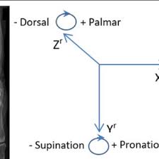 Image result for D.A.R.E!! Development + RadiSense III Y-Axis