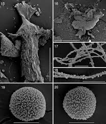 Attēlu rezultāti vaicājumam “Diderma umbilicatum stalked”