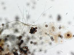 Attēlu rezultāti vaicājumam “Didymium squamulosum spores”