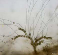 Attēlu rezultāti vaicājumam “Bulbochaete mirabilis”