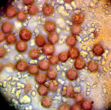 Attēlu rezultāti vaicājumam “Lycogala fuscoolearium young”