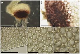 Attēlu rezultāti vaicājumam “Tritomaria exsectiformis cells”