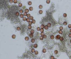 Attēlu rezultāti vaicājumam “Physarum contextum spores”