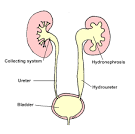 www.edrep.org - <b>Obstruction</b> of the <b>urinary</b> tract