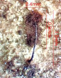 Attēlu rezultāti vaicājumam “Stemonitopsis subcaespitosa spores”