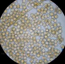 Attēlu rezultāti vaicājumam “Dictydiaethalium plumbeum spores”